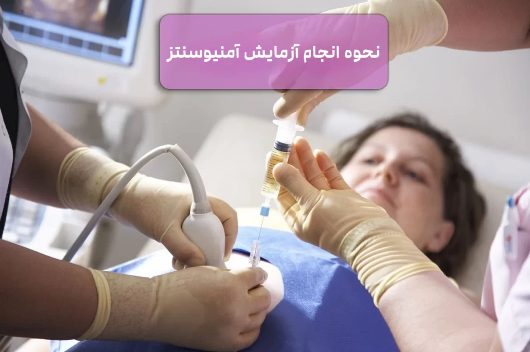 نحوه انجام آمنیوسنتز