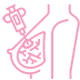 وکیوم بیوپسی
