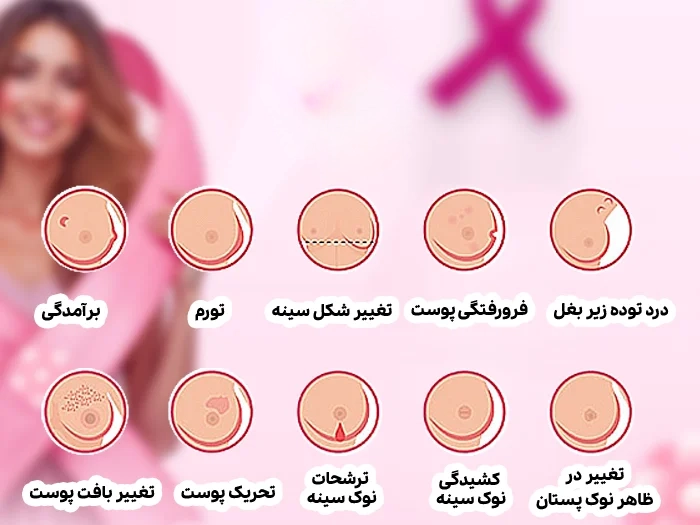 پیشگیری از سرطان پستان