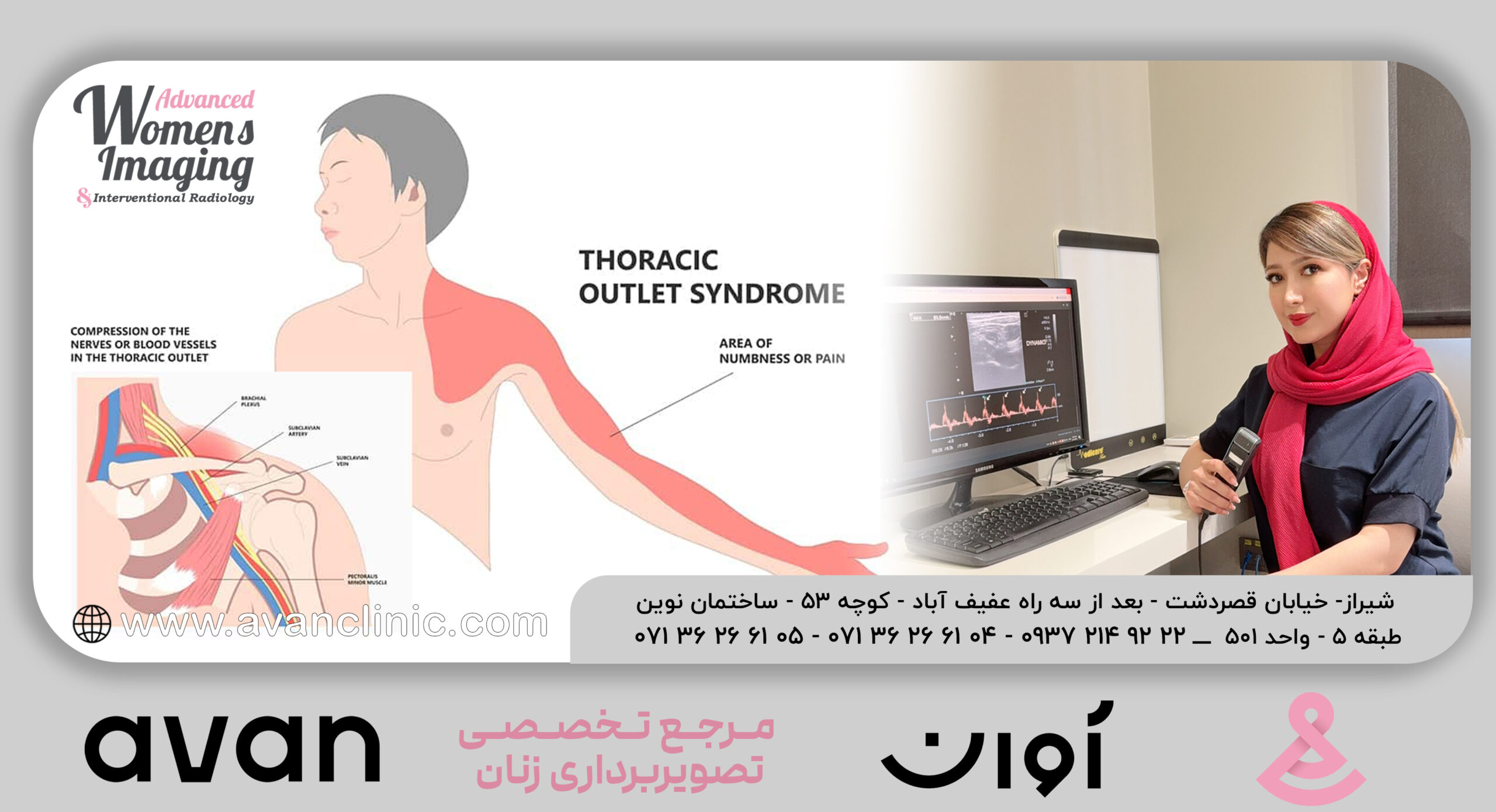 سندروم خروجی قفسه سینه