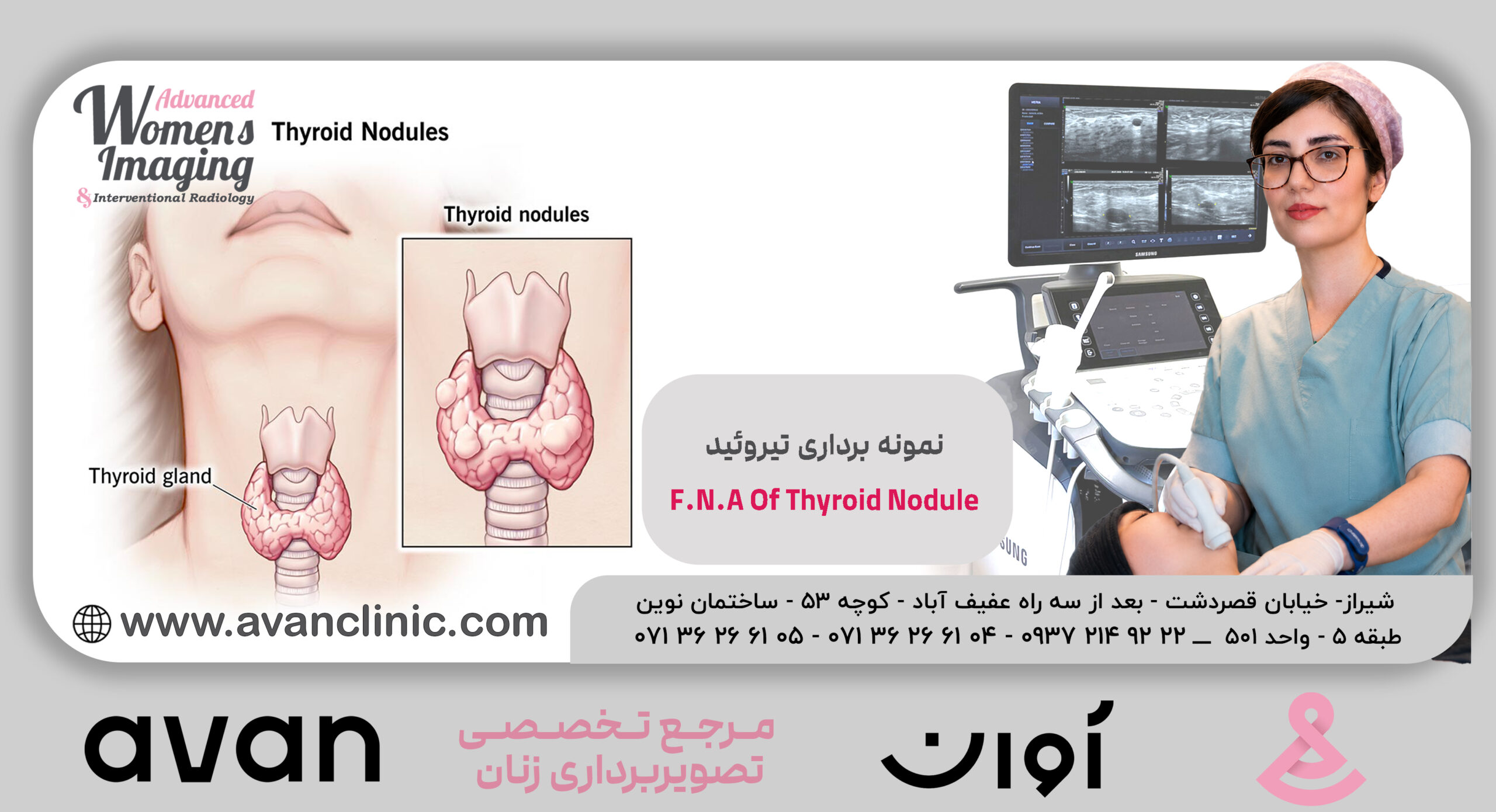 نمونه برداری تیروئید